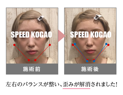 【公式】Speed小顔（スピード小顔） | 多数のモデル・芸能人さんも通う小顔サロン。理論・技術も本物！