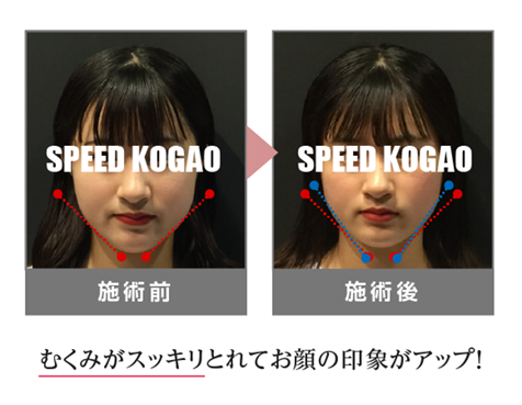 公式】Speed小顔（スピード小顔） | 多数のモデル・芸能人さんも通う小顔サロン。理論・技術も本物！